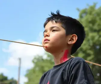 Menino de 9 anos sofre corte no pescoço por linha com cerol enquanto brincava em praça de São Bernardo