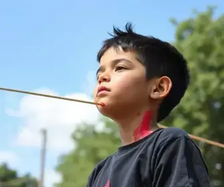 Menino de 9 anos sofre corte no pescoço por linha com cerol enquanto brincava em praça de São Bernardo